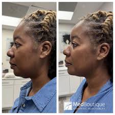 THE BEST 10 PLASTIC SURGEONS near PINEVILLE, NC 28134