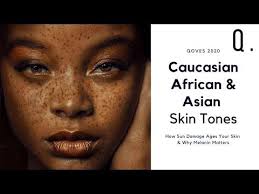 What Skin Tones Age The Best Sun Damage Wrinkles The Role Of Melanin Youtube Asian Skin Tone Melanin Skin Tones