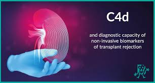 Image result for Transplant Rejection