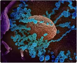 The Changing Face Of The Covid 19 Epidemic