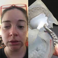 Soups and smoothies for easy mashing after dental surgery