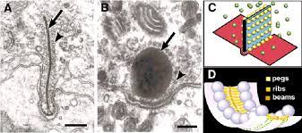 Habt ihr das schon mal gehört oder redet sie blödsinn? Ribbon Synapse Diversity And Organization A B Transmission Electron Download Scientific Diagram