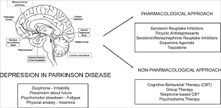 Drug Choices And Advancements For Managing Depression In Parkinson S Disease Bentham Science