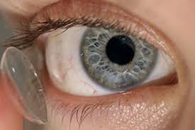 Ortho K Orthokeratology Complete Guide Overnight Contacts Lasik Ortho