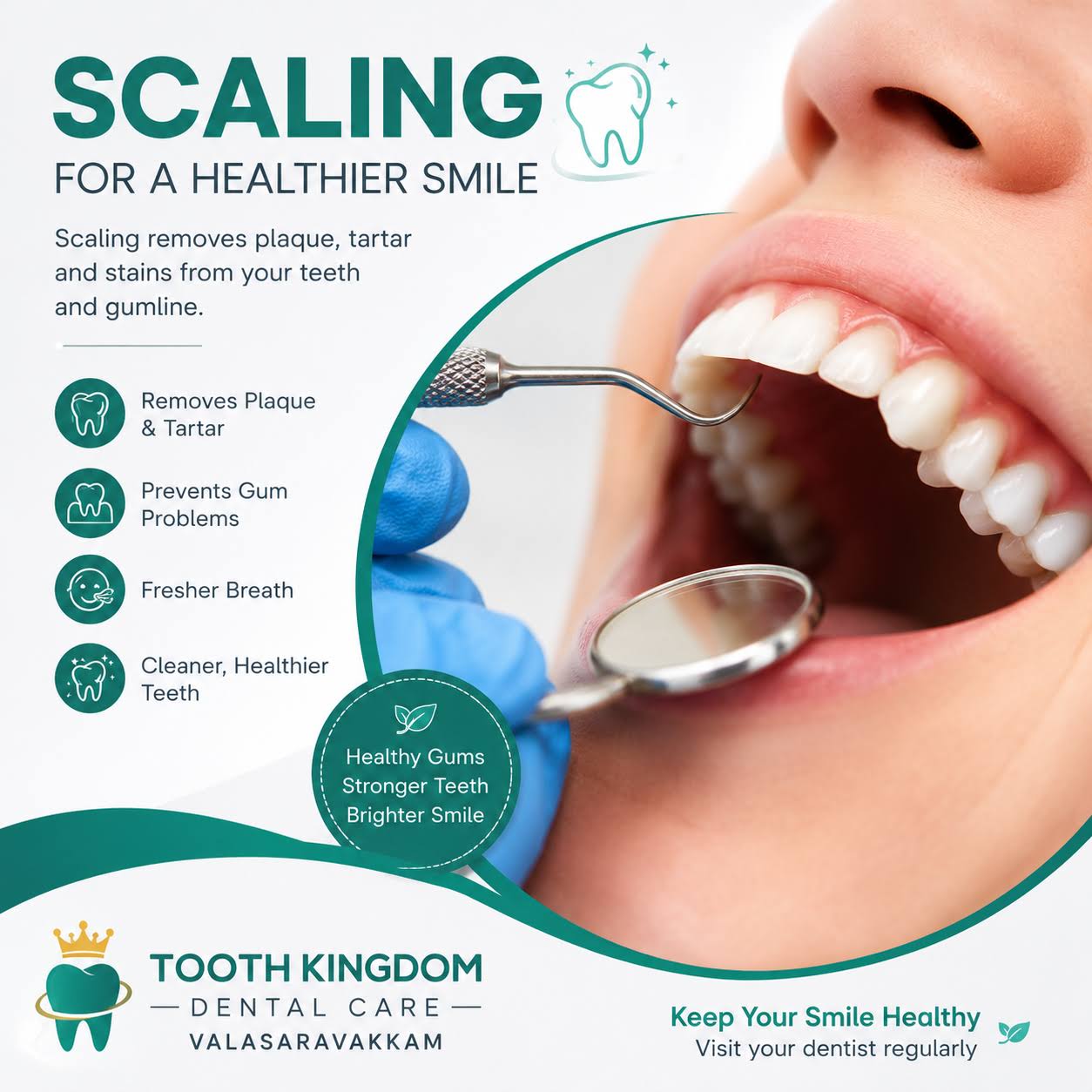 Teeth Cleaning & Polisghing