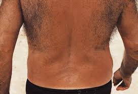 Simple & effective tips to feel confident when growing your body hair. 19 Health Problems In Men Snoring Hair Loss And More