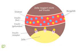 Diabetes Mellitus Typ 2 Ursachen Symptome Behandlung Onmeda De