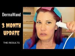 Check spelling or type a new query. Video Derma Wand