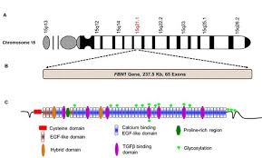 Marfan Syndrome The Medical Biochemistry Page