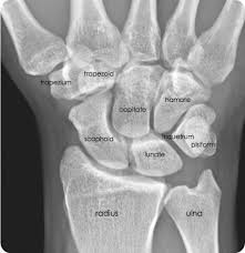 Palmar X Ray Anterioposterior View Www Anatomynote Com Medical Knowledge Medical Anatomy Radiology Student
