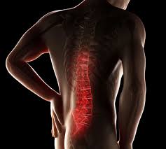 You may also have back stiffness, decreased movement of the lower back, and difficulty standing straight. Lower Back Pain Treatment Causes Symptoms Relief Physiotherapy