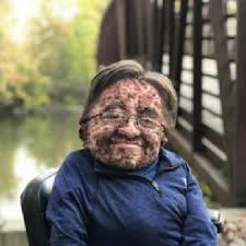 Andrew Foster Obituary (2000