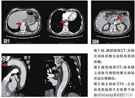 56829 12 3 4 5 6 7 8 9 10. ä¸­å¹´äººçé±å½¢æ®ºæ ä¸»åèå¤¾å±¤ çªç¶æ'è£æ¨£è¸ç æ­»äº¡çå¾é« æ¯æ¥é ­æ¢