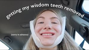 🌈 MY WISDOM TOOTH REMOVAL AND RECOVERY STORY