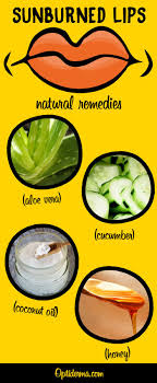 Sunburned Lips How To Treat Sun Blisters On Lips Naturally Sunburned Lips Blister On Lip Sun Blisters