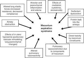 8 Meconium Aspiration Syndrome Ideas Syndrome Aspire Nicu Nurse
