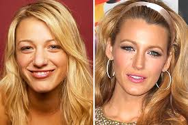 Maybe you would like to learn more about one of these? 10 Celebrities Who Had Plastic Surgery Way Too Early In Life Onedio Co
