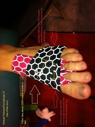 Www Kttape Com View Topic Mortons Neuroma Kinesiology Taping Kt Tape Massage Benefits