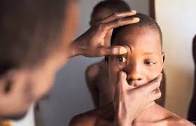 Neglected Diseases of Neglected People: The Case for Investing in Neglected  Tropical Diseases