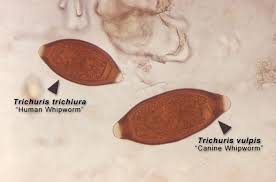 Image result for Whipworm