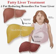 Xenical Liver Diet Drugs Alli And Xenical May Cause Liver Failure