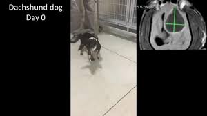 Biden had previously had a brain lesion removed in 2013. Zika Combats Advanced Stage Central Nervous S Eurekalert