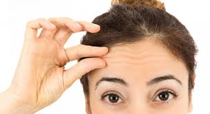 Rosenthal, md, fairfield plastic botox forehead before after pic. What Is The Best Age To Have Botox Treatment