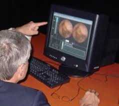 Image result for Virtual Endoscopy