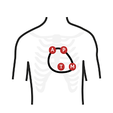 Document covering atherosclerotic disease of extracranial carotid and vertebral, mesenteric, renal, upper and lower extremity arteries Heart Auscultation Cardio Exam Medschool