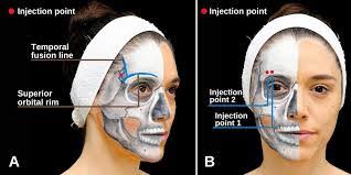 Rebecca Ignacio's Instagram, Twitter & Facebook