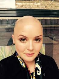 Female pattern baldness involves a typical pattern of hair loss in women, due to hormones, aging, and genes. Female Hair Loss Six Women On What Causes Hair Loss And Their Experience