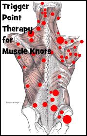 Pin On Muscle Knots