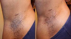 Beauty My European Wax Center Experience Underarm Waxing Fabellis