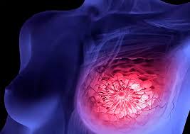 Often this turns out to be gynecomastia, or simply a concentration of male breast tissue that can be felt through the skin. Baron Pharmacy