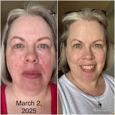 Angela Deem's Skincare Secrets and Amazon Routine