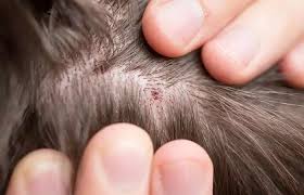 Image result for white scabs on the head in children
