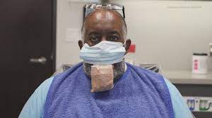 Why do some people get side effects after covid vaccines? Swollen Tongue New Covid Side Effect Khou Com