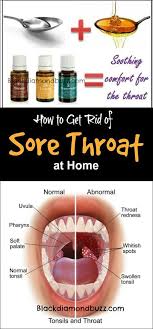 Sore Throat Remedies How To Get Rid Of Sore Throat Fast At Home Using Essential Oil Honey Oils For Sore Throat Sore Throat Essential Oils Essential Oil Remedy