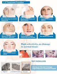 (i wish!) a complete tattoo removal takes a minimum of 2 1/2 years on average, says bethany cirlin, tattoo removal specialist. Laser Tattoo Removal The House Of Nails