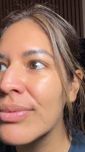 Why microneedling before neurotoxin is the real glow secret 💉✨  Microneedling repairs, reverses, and boosts collagen… then neurotoxin  maintains, smooths, and prevents future lines. When you combine both, your  skin stays tighter,