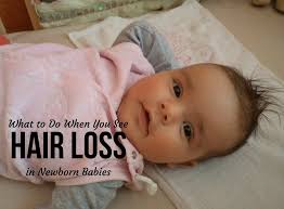 If your child has ringworm, for example. What To Do When You See Hair Loss In Newborn Babies Babycare Mag