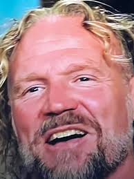 Dental Drama! Kody Brown's New Front Teeth Leave Viewers Speechless👇