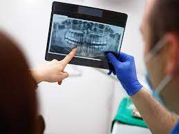Fluoride is an important mineral for reversing tooth decay and protecting your teeth from further damage. Can You Reverse A Cavity How To Stop And Prevent Tooth Decay