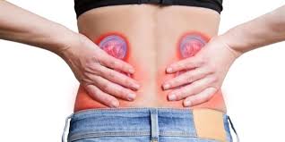 How To Remove Kidney Stones | Treatment | Symtoms | Causes