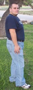 What was your life like before bariatric surgery? Men S Weight Loss Surgery Success Stories Bmi Of Texas