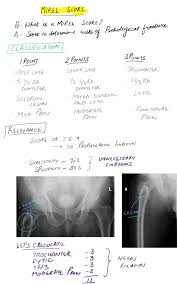 Mirel Score Determining Risk Of Pathological Fracture And Need To Prophylactic Fix A Bone With A Lesion Pathology Scores Fracture