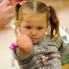 Brave Merseyside girl Amber Travers