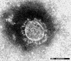 Antigen Test That Rapidly Detects Coronavirus Ok D For Use In Japan The Asahi Shimbun