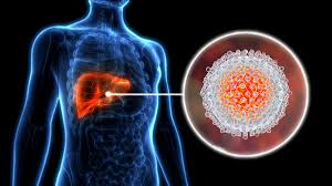 Image result for hepatitis symptoms
