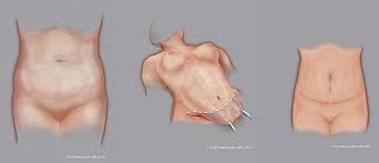 Image result for Umbilicus